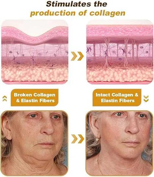 Botox Bee Venom Cream